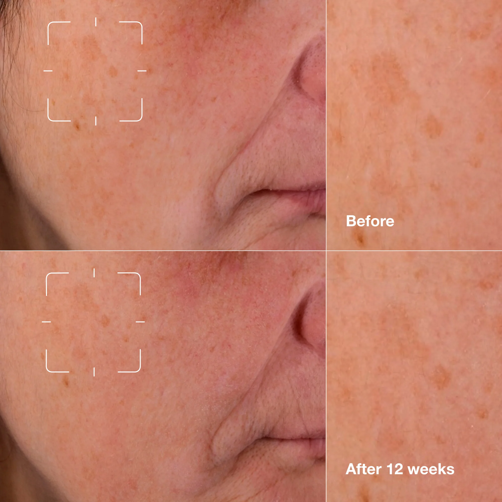 Even Better Clinical™ Dark Spot Clearing Serum with Vitamin C - Image 9